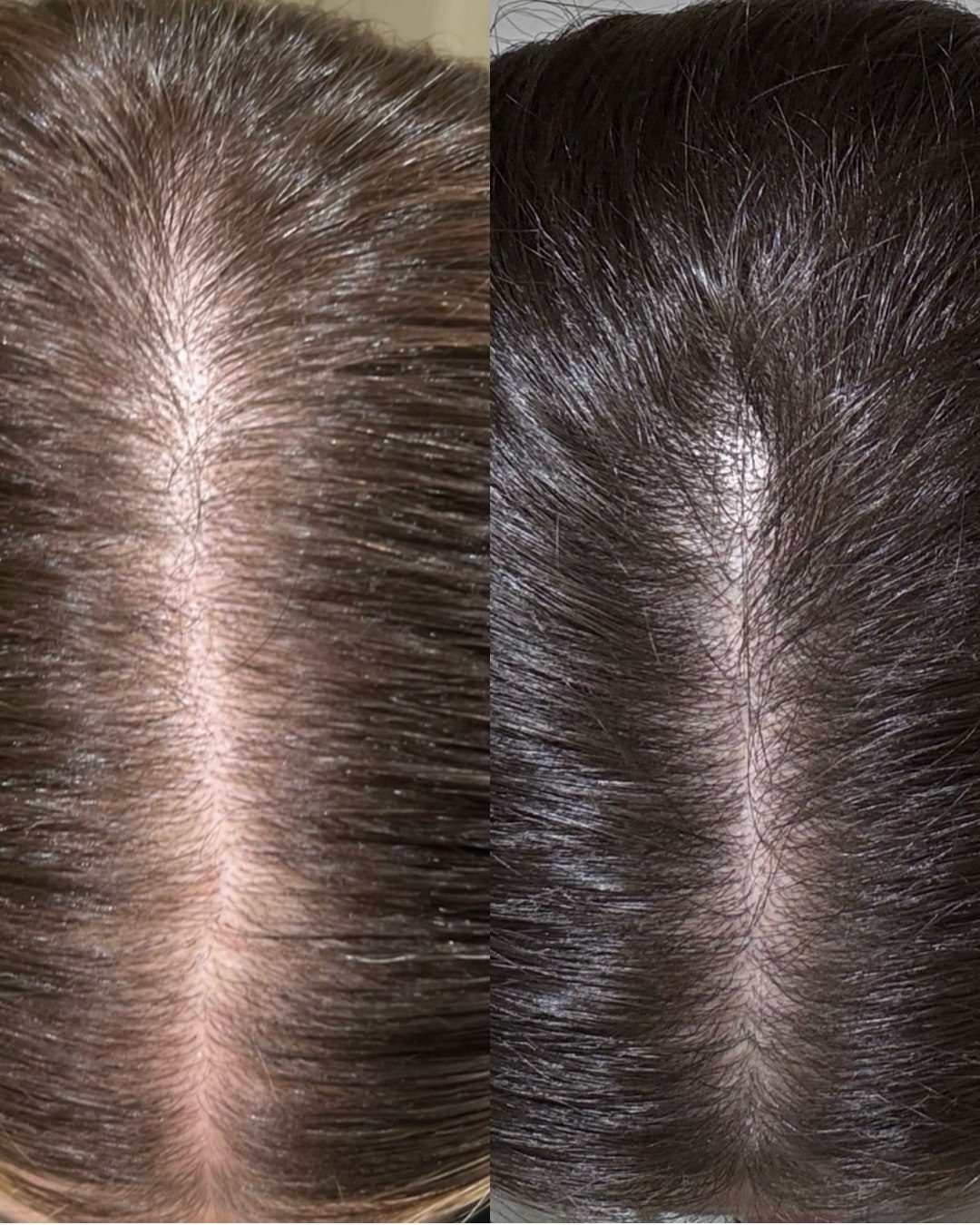 DSD Dixidox DeLuxe Forte Lotion № 3.4 - Лосьон против выпадения и стимуляции роста волос 