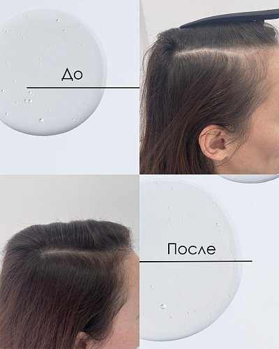 DSD Dixidox De Luxe Intense Shampoo № 3.1 - Интенсивный шампунь от выпадения волос 