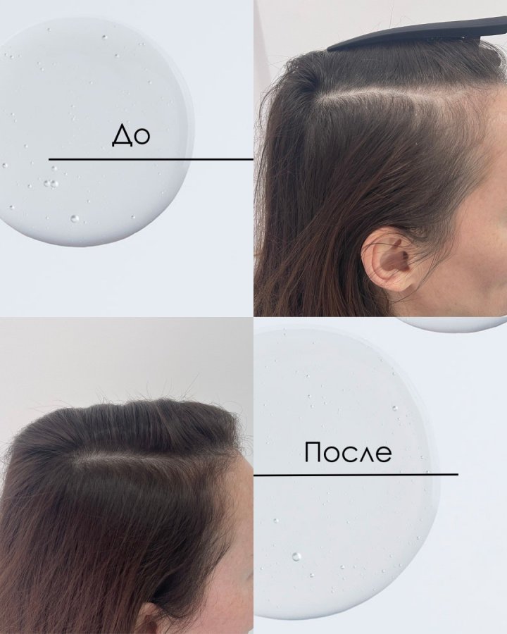 DSD Dixidox De Luxe Intense Shampoo № 3.1 - Интенсивный шампунь от выпадения волос 