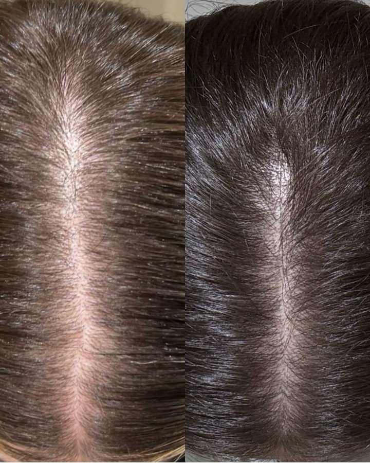 DSD Dixidox DeLuxe Forte Lotion № 3.4 - Лосьон против выпадения и стимуляции роста волос 