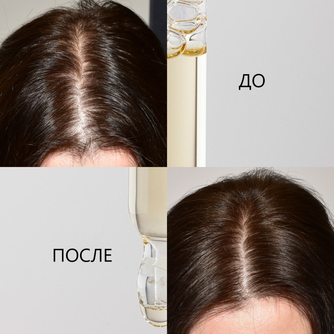 DSD De Luxe Fresh Cells DeLuxe Wondercell Lotion № 3.4.3А - Лосьон для интенсивного роста волос Флакон 50мл + ампула 10мл 